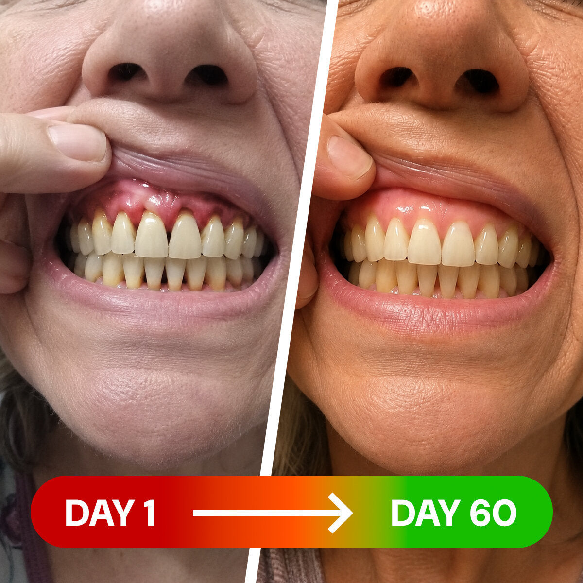 Reverse Receding Gums In Just 12 Minutes A Day..
