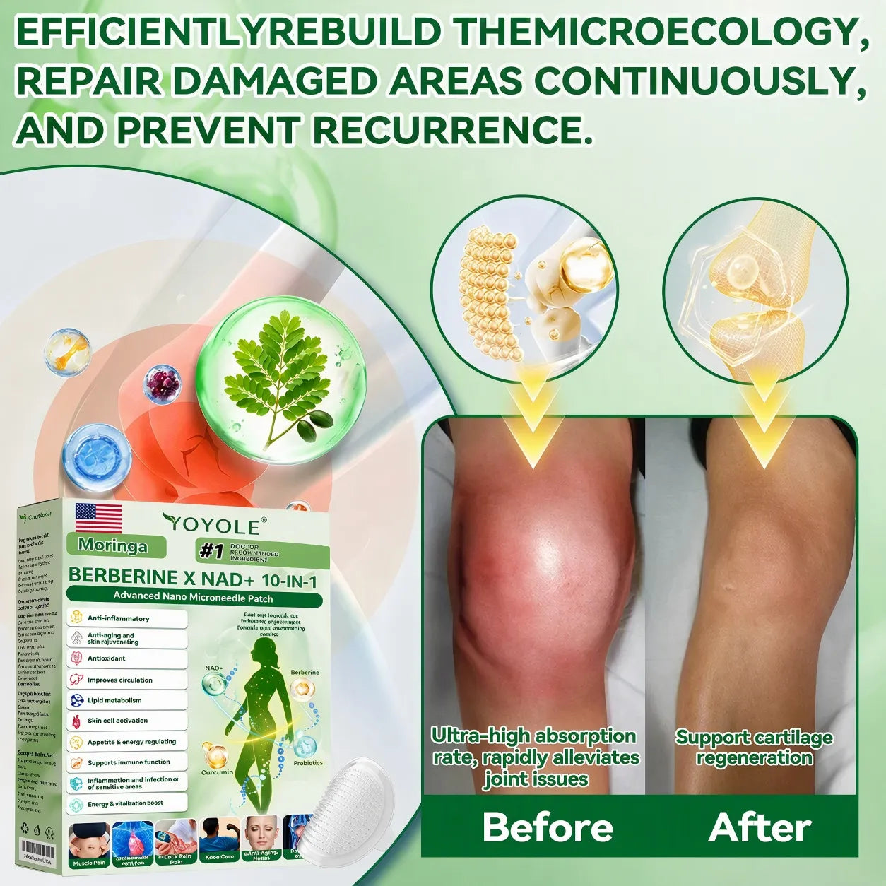 Official Store | YOYOLE® BERBERINE X NAD+ 10-IN-1 Advanced Nano Microneedle Patch (once daily, visible changes within 7 days) Obesity, diabetes, sleep apnea, and joint problems🎯🎯🎯